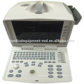 Best price doppler ultrasound machine Black and White ultrasound machine with CE & ISO approved